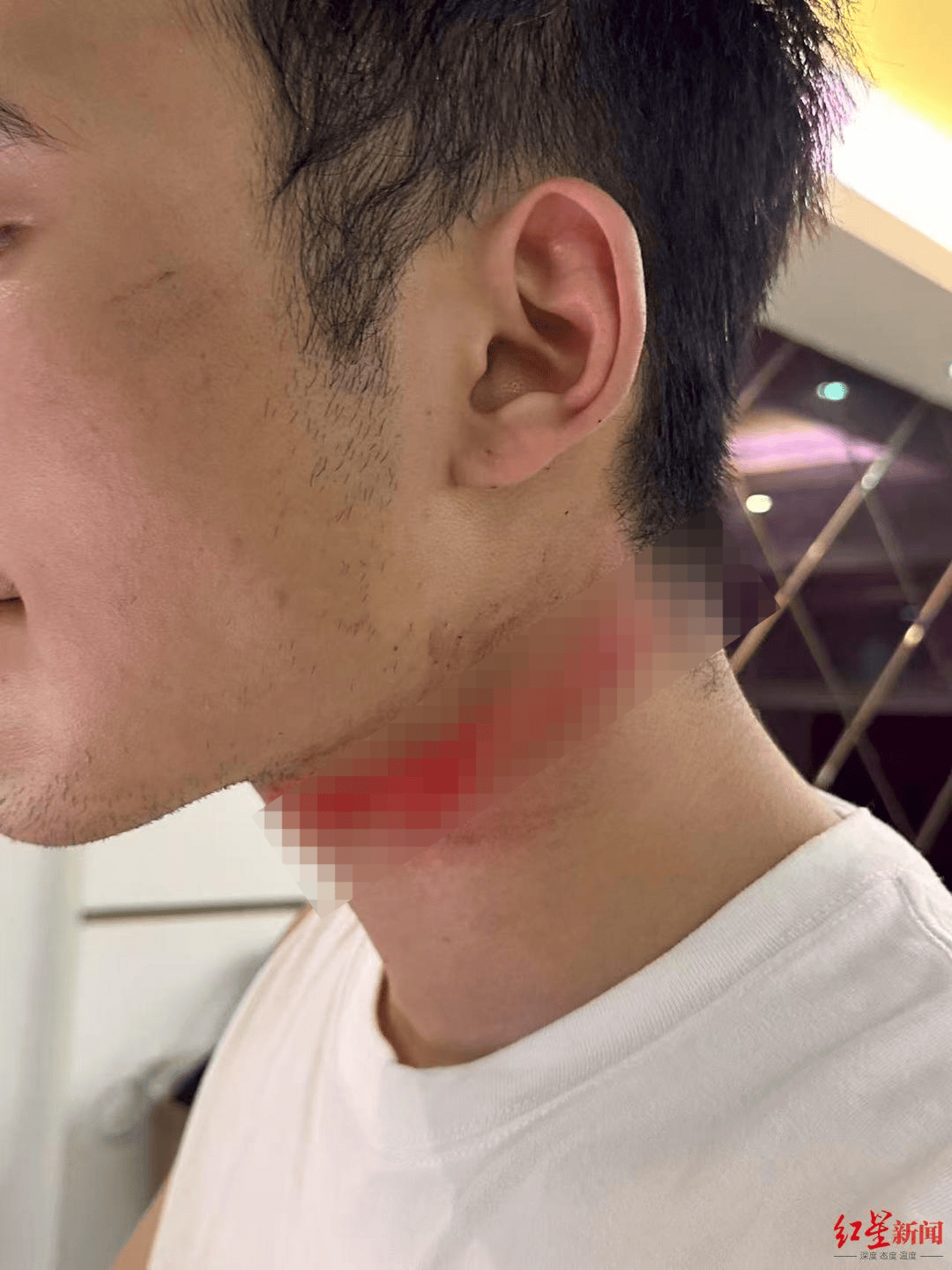 男主播骑车载女友回家被路边掉落网线勒伤脖子<strong></p>
<p>tube币</strong>，索赔3万陷僵局 律师解读该谁赔
