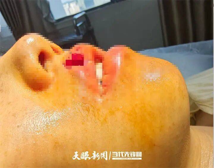 女子上门代喂<strong></p>
<p>随享币</strong>，被100多斤阿拉斯加犬咬伤遭毁容，狗主人称不担全责