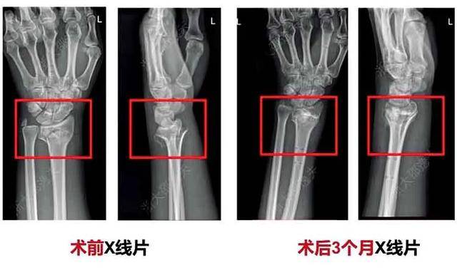 世界性难题<strong></p>
<p>币币机</strong>,攻克了?