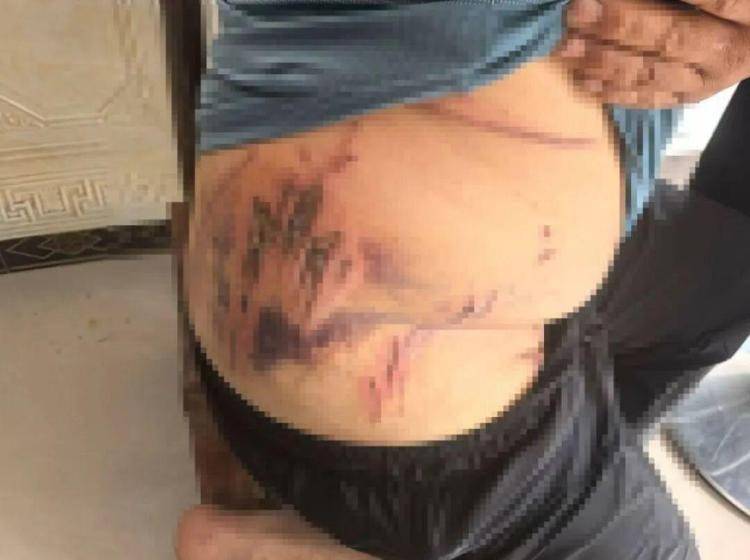 湖北鹤峰县疑再现老虎踪迹<strong></p>
<p>法币时代</strong>,村民家猪遭袭,玉米地发现脚印,此前男子自称干农活时被抓伤,当地回应